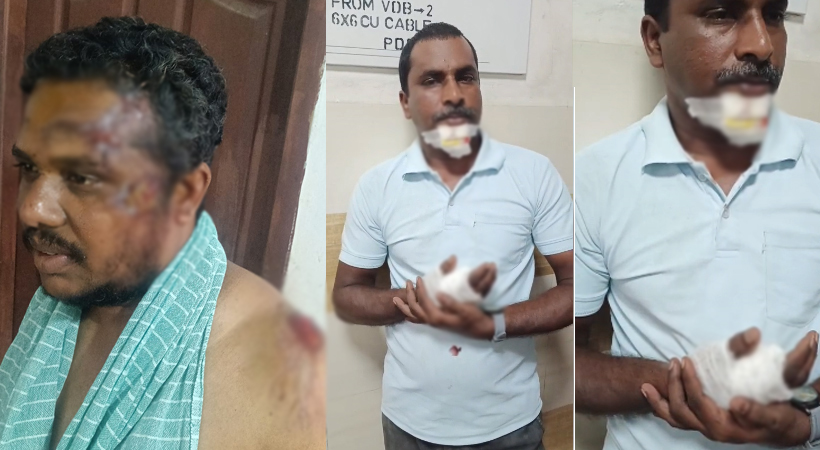 കാട്ടുപന്നി ആക്രമണം രൂക്ഷം