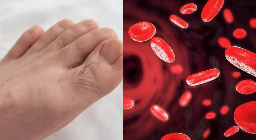 poor blood circulation symptoms